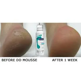 Footlogix DD Cream Mousse